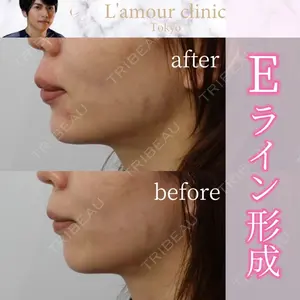 L‘amour clinic Tokyo【ラムールクリニック東京】の症例