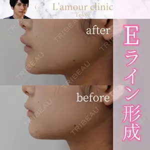 L‘amour clinic Tokyo【ラムールクリニック東京】の症例