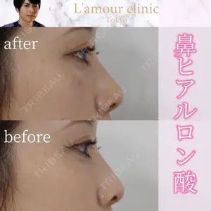 L‘amour clinic Tokyo【ラムールクリニック東京】の症例