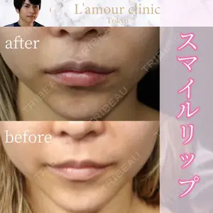 L‘amour clinic Tokyo【ラムールクリニック東京】の症例