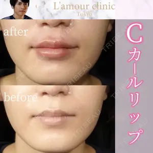 L‘amour clinic Tokyo【ラムールクリニック東京】の症例