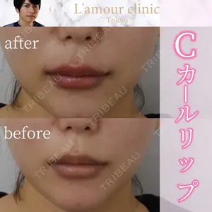 L‘amour clinic Tokyo【ラムールクリニック東京】の症例