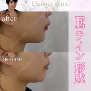 L‘amour clinic Tokyo【ラムールクリニック東京】の症例