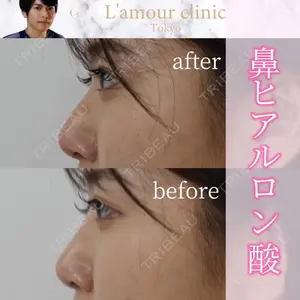 L‘amour clinic Tokyo【ラムールクリニック東京】の症例