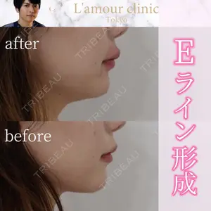 L‘amour clinic Tokyo【ラムールクリニック東京】の症例