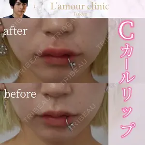 L‘amour clinic Tokyo【ラムールクリニック東京】の症例