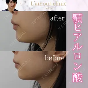 L‘amour clinic Tokyo【ラムールクリニック東京】の症例