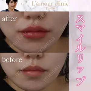 L‘amour clinic Tokyo【ラムールクリニック東京】の症例