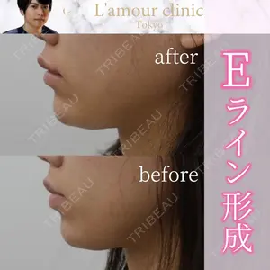 L‘amour clinic Tokyo【ラムールクリニック東京】の症例