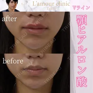 L‘amour clinic Tokyo【ラムールクリニック東京】の症例