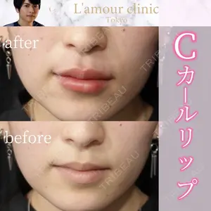 L‘amour clinic Tokyo【ラムールクリニック東京】の症例