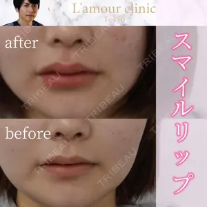 L‘amour clinic Tokyo【ラムールクリニック東京】の症例