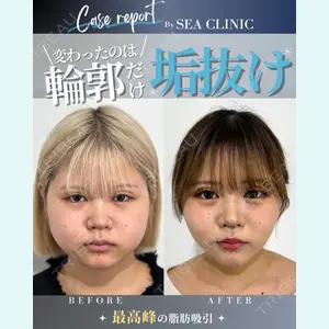 SEA CLINIC（シークリニック）の症例