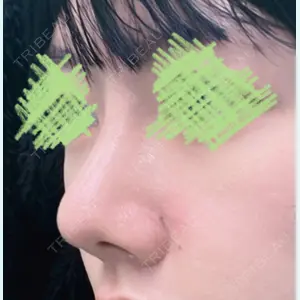 症例