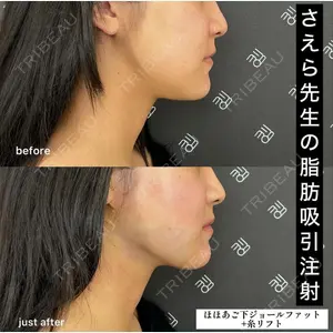 EMMO FACE CLINIC 大阪梅田院 山﨑 冴羅医師の症例