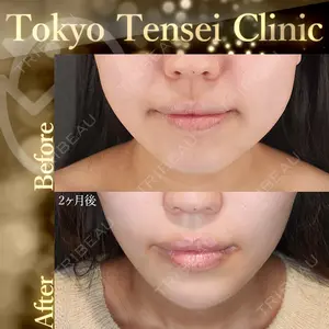 Tokyo Tensei Clinic 新宿院 辻 大成医師の症例