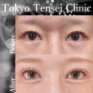 Tokyo Tensei Clinic 新宿院 沖津 勇気（ブレイブ沖津）医師の症例