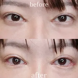 Tokyo Tensei Clinic 新宿院 沖津 勇気（ブレイブ沖津）医師の症例