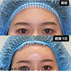 APOLLO BEAUTY CLINIC 鬼沢 正道医師の症例