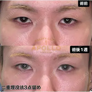 APOLLO BEAUTY CLINIC 鬼沢 正道医師の症例