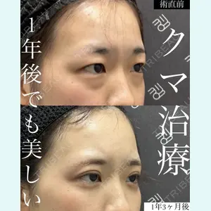 EMMO FACE CLINIC 大宮院 廣松 直樹医師の症例