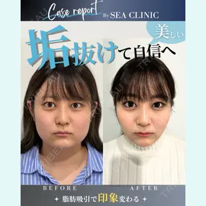 SEA CLINIC（シークリニック） 沼澤 茂医師の症例
