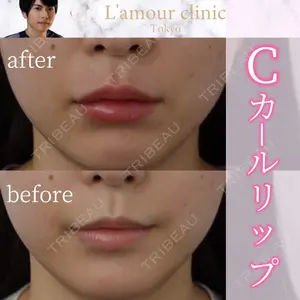 L‘amour clinic Tokyo【ラムールクリニック東京】の症例