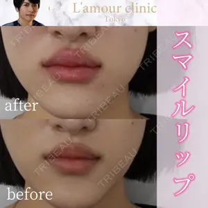 L‘amour clinic Tokyo【ラムールクリニック東京】の症例