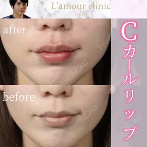 L‘amour clinic Tokyo【ラムールクリニック東京】の症例