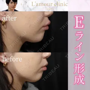 L‘amour clinic Tokyo【ラムールクリニック東京】の症例