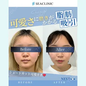 SEA CLINIC（シークリニック） 沼澤 茂医師の症例