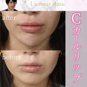 L‘amour clinic Tokyo【ラムールクリニック東京】の症例