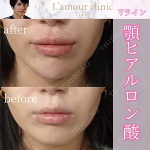 L‘amour clinic Tokyo【ラムールクリニック東京】の症例