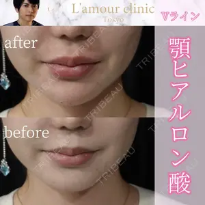 L‘amour clinic Tokyo【ラムールクリニック東京】の症例