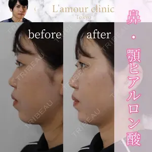 L‘amour clinic Tokyo【ラムールクリニック東京】の症例