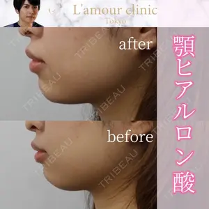 L‘amour clinic Tokyo【ラムールクリニック東京】の症例