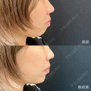 東京シンデレラ美容外科 大宮院の症例