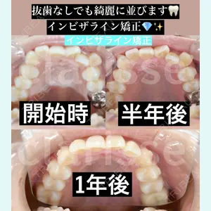 オーラルビューティークリニック クラリス審美歯科・矯正歯科 引野 貴之医師の症例