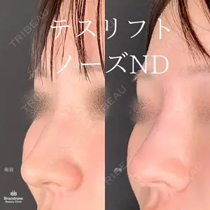 Brandnew Beauty Clinicの症例