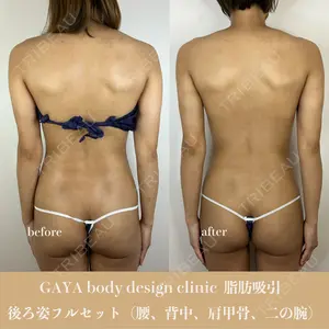 GAYA body design clinicの症例