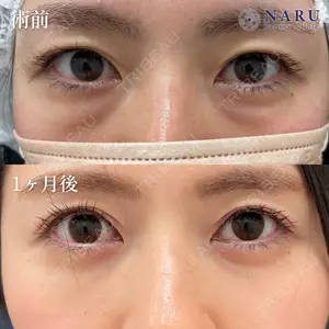 NARU Beauty Clinic 【ナルクリ】 地引 輔医師の症例