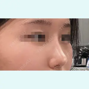 症例