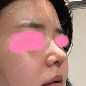 症例
