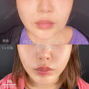Brandnew Beauty Clinicの症例