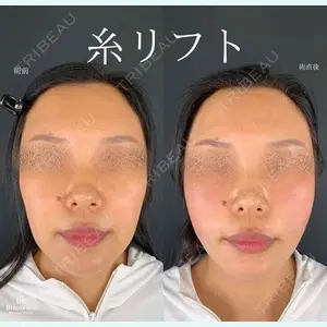 Brandnew Beauty Clinicの症例
