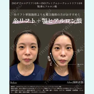 INO BEAUTY CLINIC 井上 紘基医師の症例