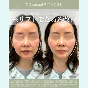 INO BEAUTY CLINIC 井上 紘基医師の症例
