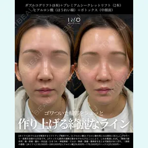 INO BEAUTY CLINIC 井上 紘基医師の症例