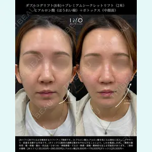 INO BEAUTY CLINIC 井上 紘基医師の症例