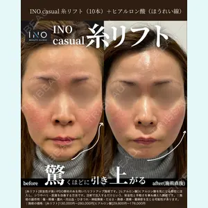 INO BEAUTY CLINICの症例